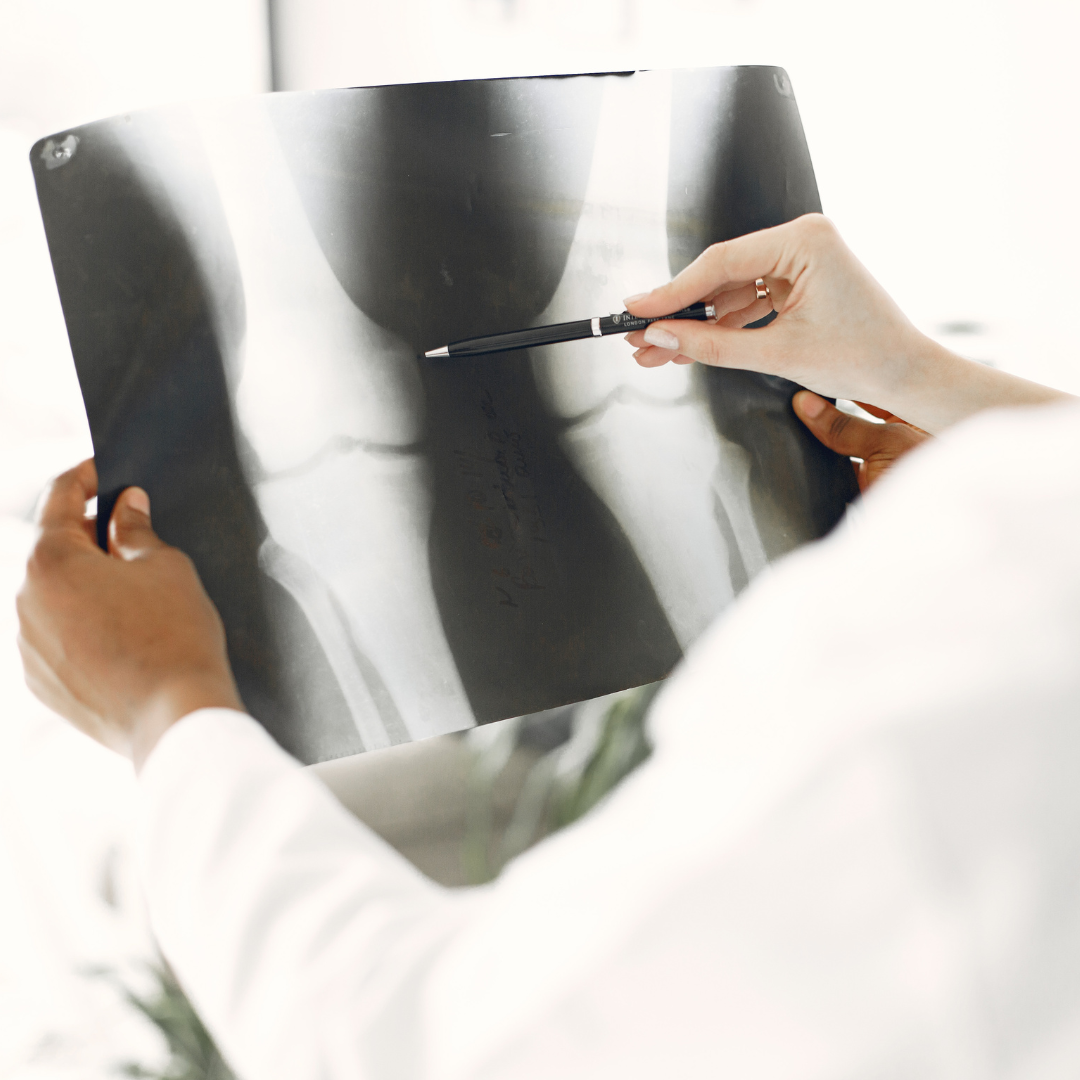 Doctor examining x-ray image for accident insurance claim