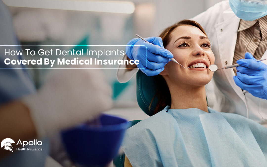How To Get Dental Implants Covered By Medical Insurance