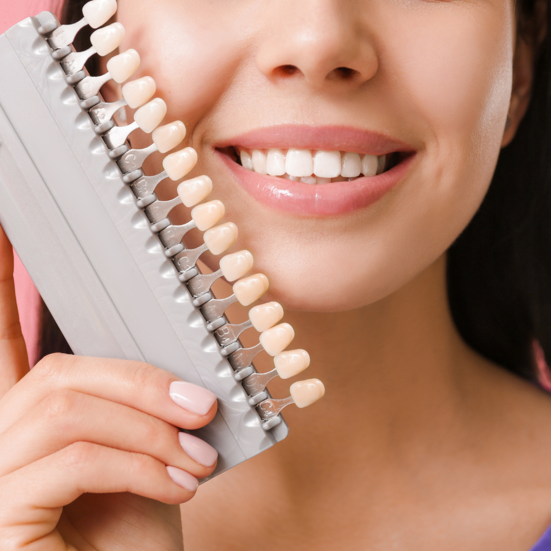 Tips for Navigating Insurance for Veneers