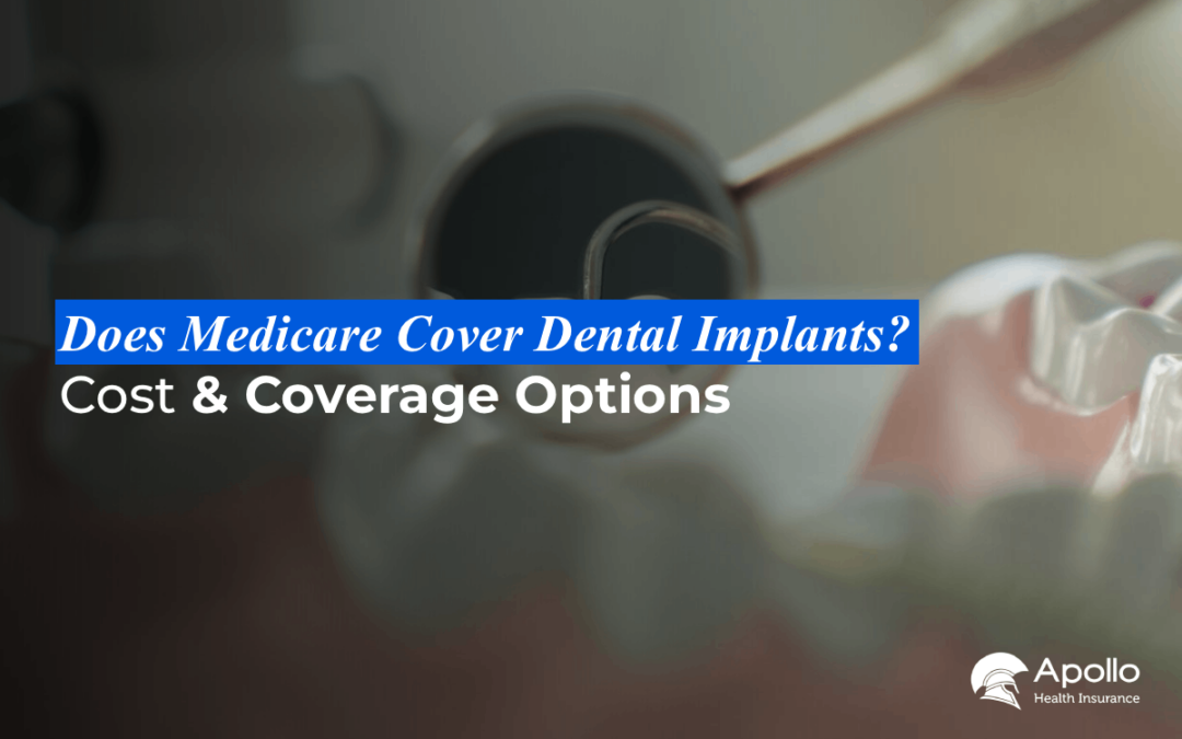 Does Medicare Cover Dental Implants cost and coverage blog banner