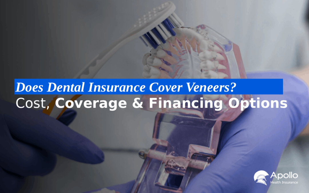 Does Dental Insurance Cover Veneers Costs, Coverage & Financing Options blog banner
